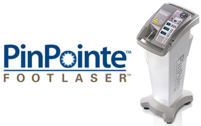 Pinpointe laser treatment for nail fungus