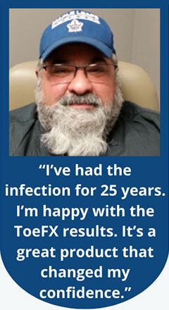toefx Treatment testimonials in the Palm Beach County, FL: Boynton Beach, West Palm Beach, Delray Beach & Boca Raton, Lantana & Lake Worth Beach, Ocean Ridge & Gulf Stream, Hypoluxo, Wellington, Greenacres, FL & Broward County, FL: Plantation, Davie, Cooper City, Lauderhill & Lauderdale Lakes, Weston, Pembroke Pines & Miramar, FL areas